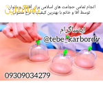 انجام دهنده انواع حجامت های اسلامی